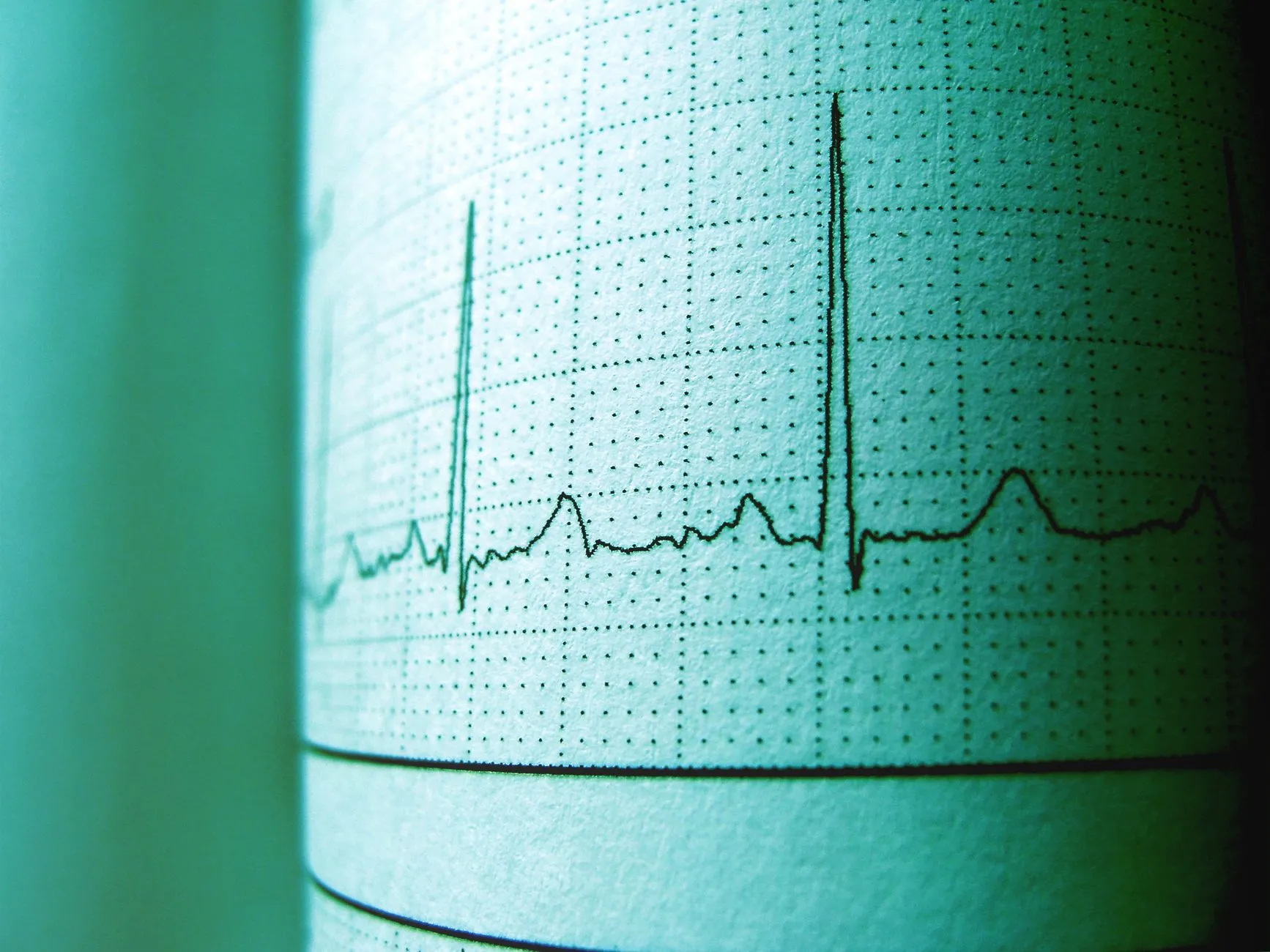 Zbliżenie na zapis EKG na papierze w zielonym oświetleniu